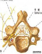 [骨骼肌图像]CT诊断和“椎骨和软骨结节”的特殊