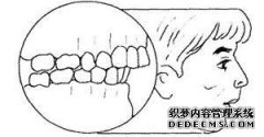 上颌骨概述