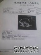 您要退出nt后停止吗？结果不会通过胎儿逮捕吗？