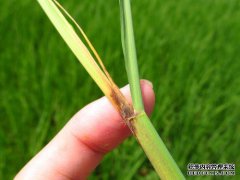 S和并发茎应尽早用药治疗