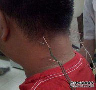 头部后部抬起。