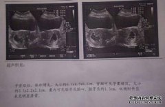 CT可以控制胃吗？