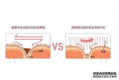 微晶换肤和激光去毛刺有什么区别？