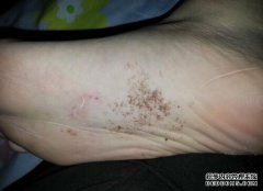 今天，我突然在脚底发现了一只小黑蝎子。
