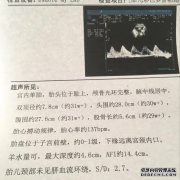b super pi是什么意思？