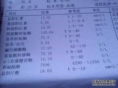 丙氨酸氨基转移酶的IUL和UL单位的转化