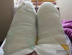 大腿疼痛