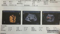 如果是生化的，可以将妊娠囊排干几天。