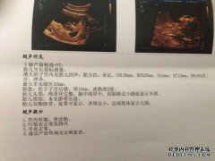 怎么检查怀孕新台币应该去早上怀孕不